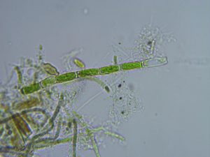 Algae Under Microscope